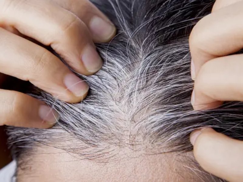 Cobertura de canas opciones según cabello